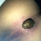 Someone put an iPhone in a toilet bowl to record a girl taking a huge, soft shit. There is so much poop that comes out of her that it completely buries the poor iPhone. Finished product shown at the end. Excellent quality video and audio!